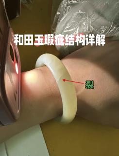 🔍拿到和田玉,先打灯仔细看!